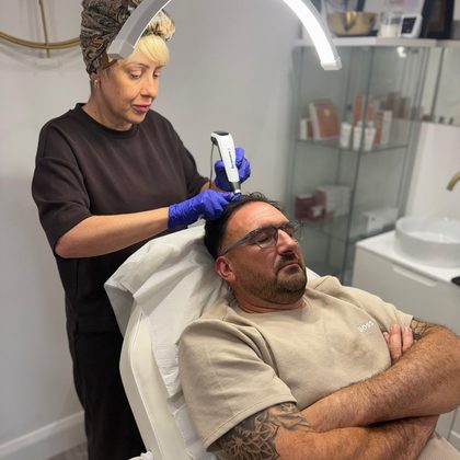 Abbie performing PRP hair restoration in her Basildon clinic