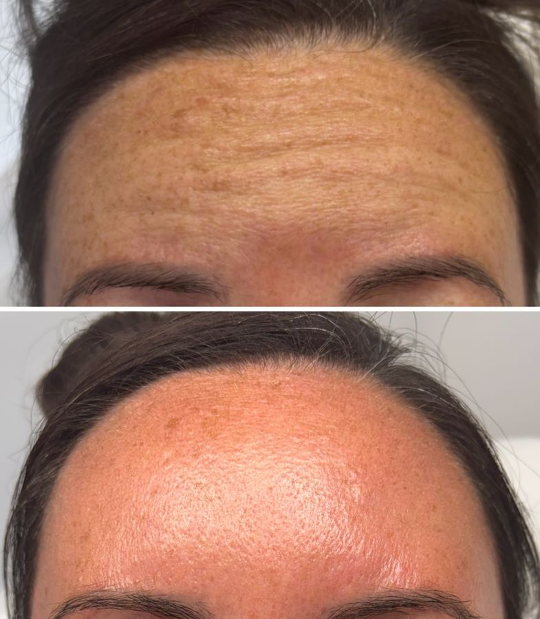 Anti-wrinkle, a subtle refresh