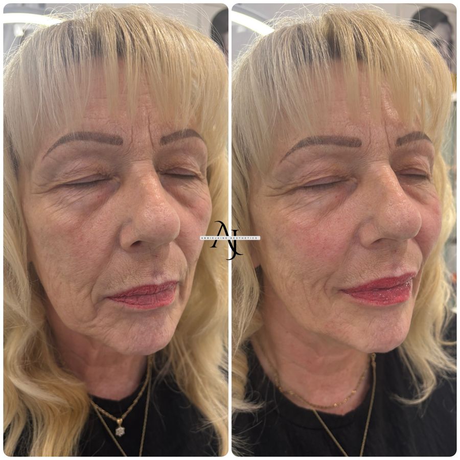 Facial restoration, before and after